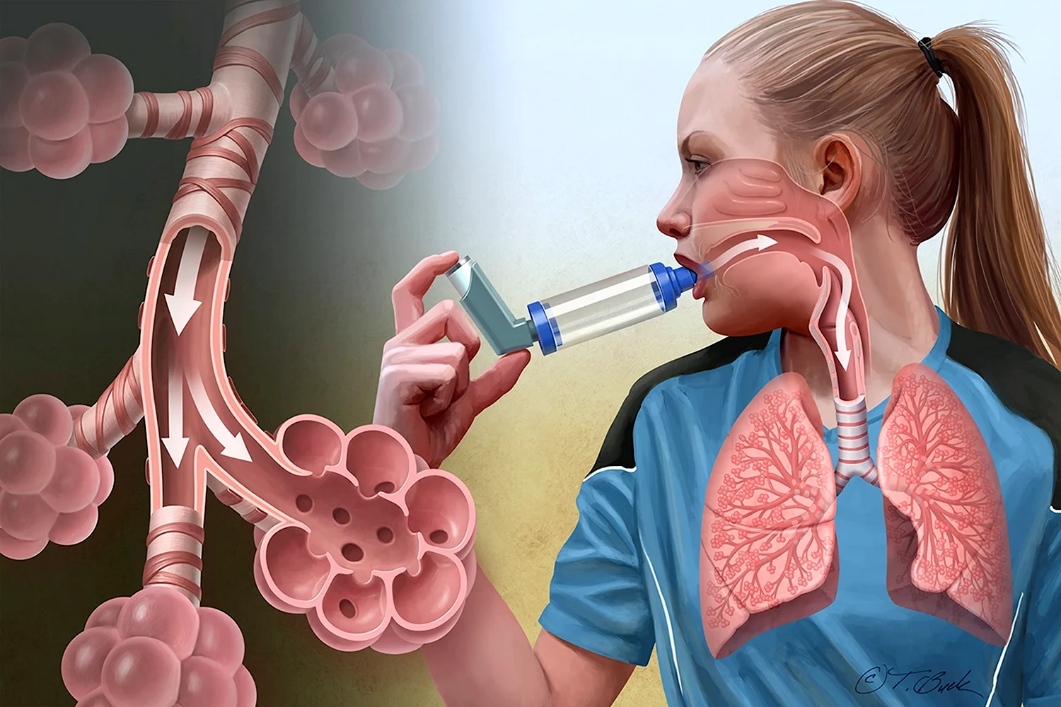 Астматическая астма
