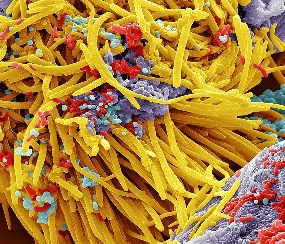 Бактериоид под микроскопом