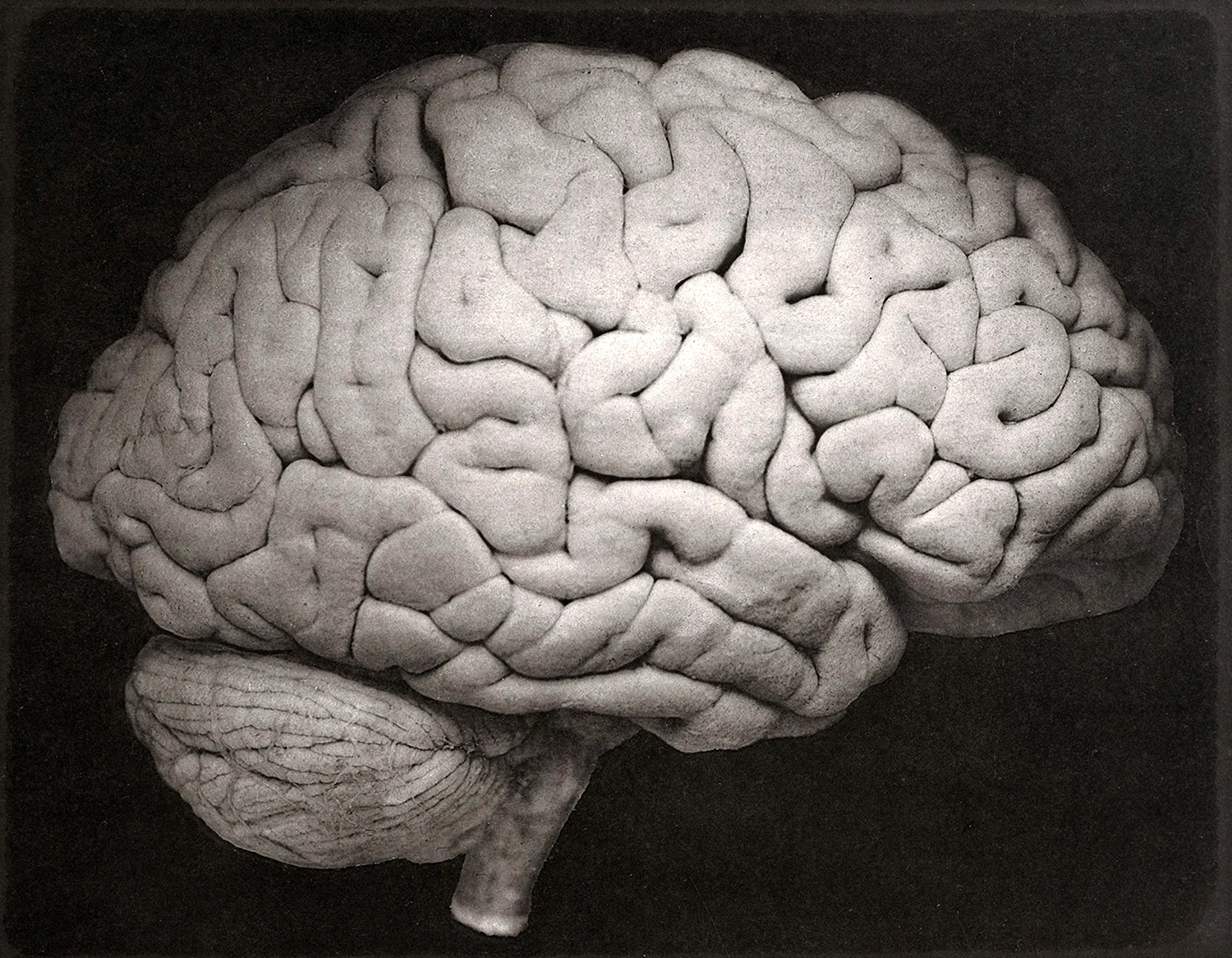 Большой мозг