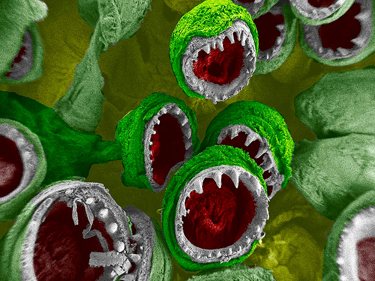 Микробы и вирусы под микроскопом