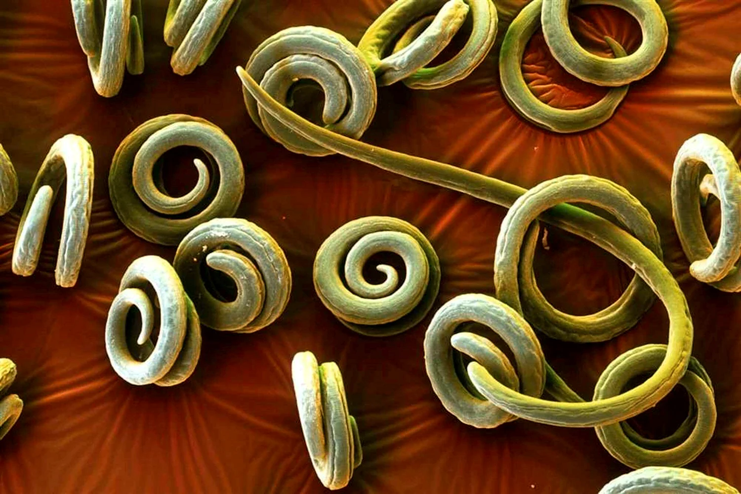 Трихинелла круглые черви