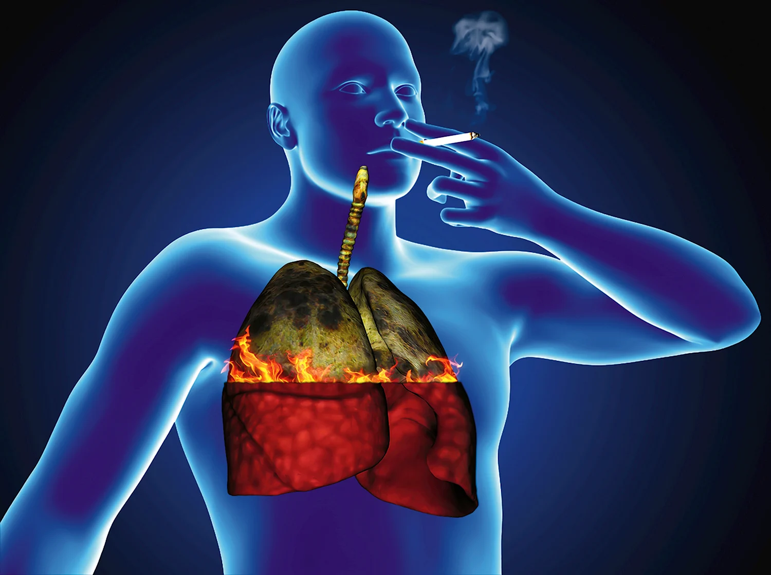 Воздействие курения на органы дыхания